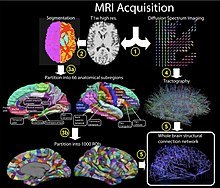 Whole brain emulation (transfer or uploading of human consciousness)