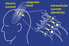 Whole brain emulation (transfer or uploading of human consciousness)