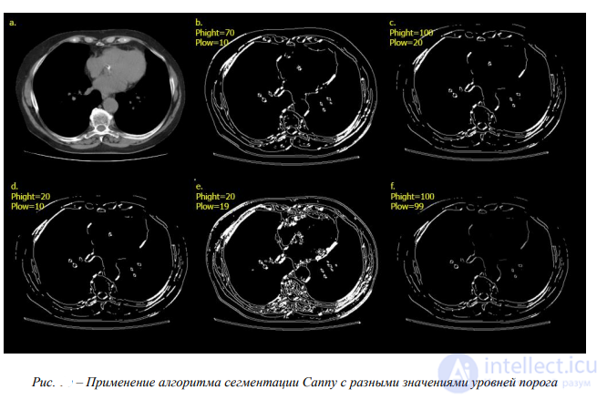 Digital Image Processing and Analysis (Image Recognition and Processing in Medicine, Satellite Imagery and Security)