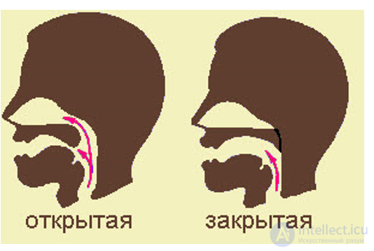 Rhinolalia and Nasality: Hypernasal Speech