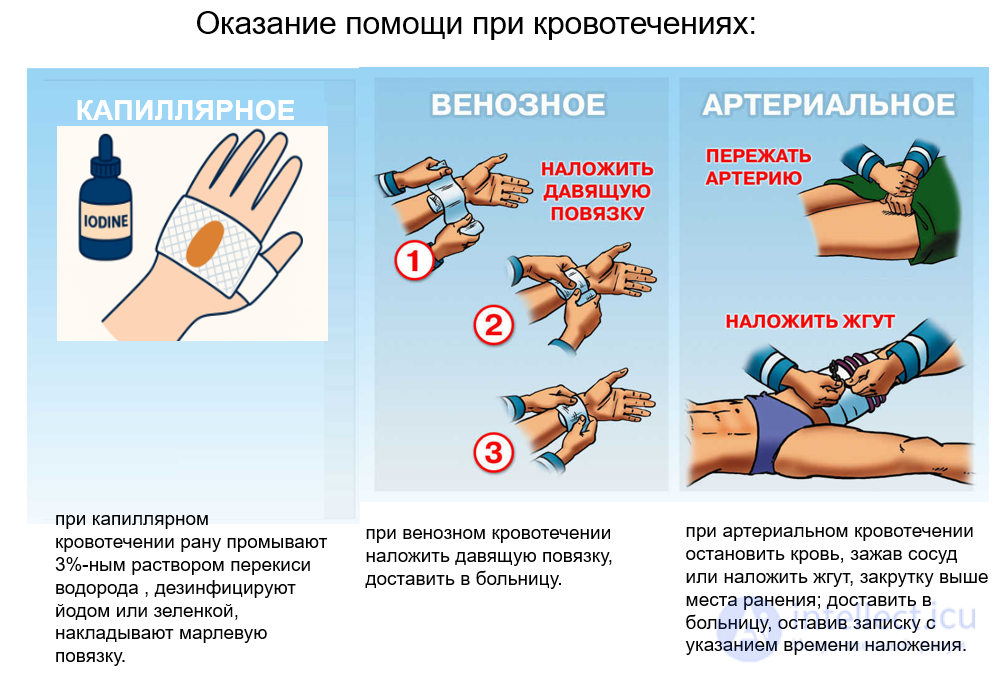 First Aid for Wounds and Bleeding. Bandaging the Wounded, Self-Aid and Mutual Aid