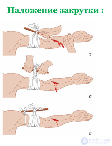 First Aid for Wounds and Bleeding. Bandaging the Wounded, Self-Aid and Mutual Aid