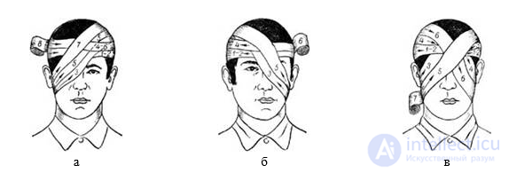 First Aid for Wounds and Bleeding. Bandaging the Wounded, Self-Aid and Mutual Aid