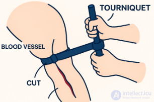 First Aid for Wounds and Bleeding. Bandaging the Wounded, Self-Aid and Mutual Aid