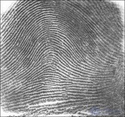 Fingerprint Sensors: Types, Design and Operating Principles
