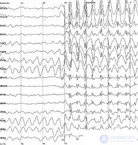   Wave neural networks.  Background activity 