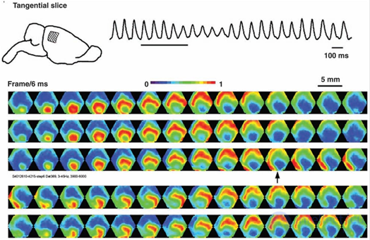   5. Waves of the brain 