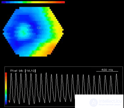   5. Waves of the brain 