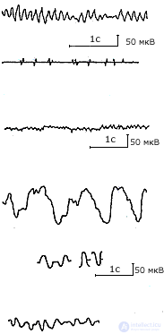 2. METHODS OF PSYCHOPHYSIOLOGY