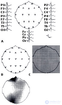 2. METHODS OF PSYCHOPHYSIOLOGY