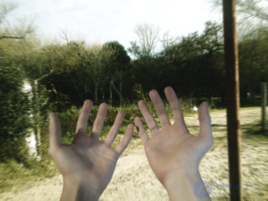 Post-Traumatic Stress Disorder (PTSD)