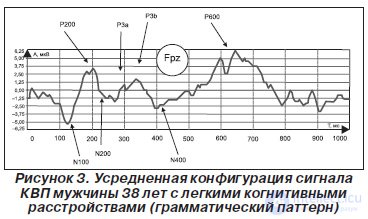   MULTIFOCAL CALLED POTENTIALS, RELATED TO THE EVENT, IN EARLY DIAGNOSTICS OF COGNITIVE DISINTEGRATION 