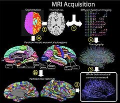 Connectome: A Complete Map of Neural Connections