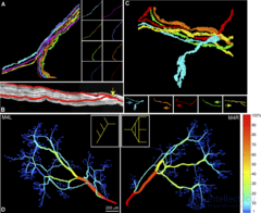 Connectome: A Complete Map of Neural Connections