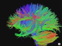 Connectome: A Complete Map of Neural Connections