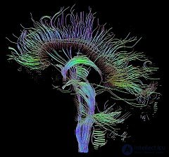 Connectome: A Complete Map of Neural Connections