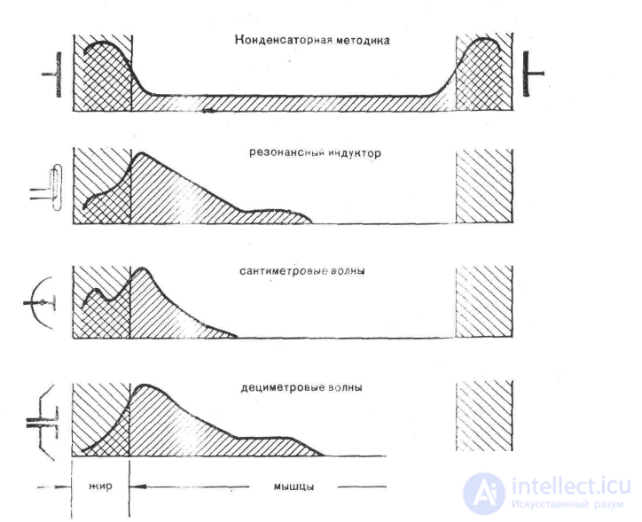 5. Therapeutic methods based on the use of high-frequency currents, devices and systems for exposure to HF, UHF and microwave radiation. Darsonvalization