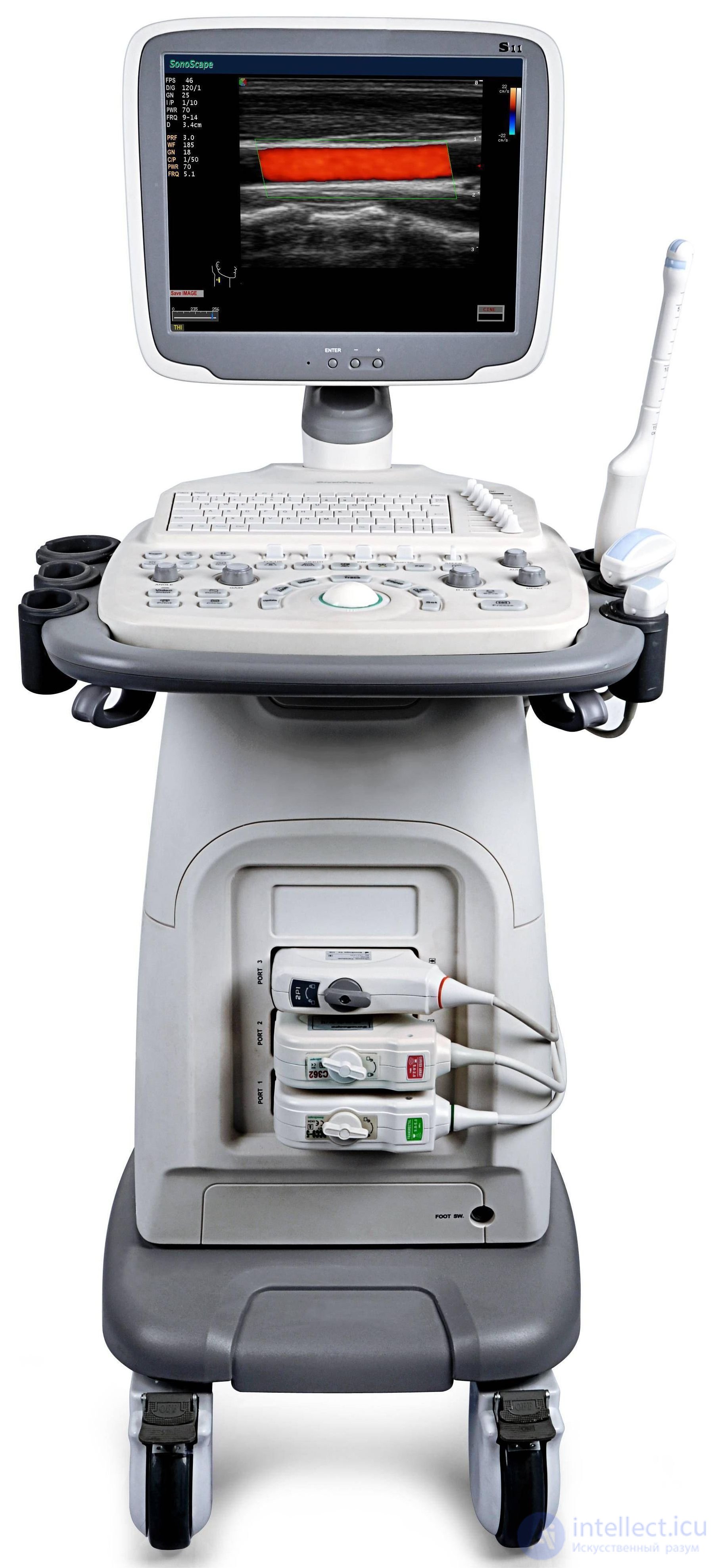 7 Ultrasound Therapy Devices, Ultrasonography, Lithotripsy