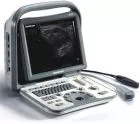 7 Ultrasound Therapy Devices, Ultrasonography, Lithotripsy