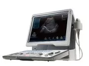 7 Ultrasound Therapy Devices, Ultrasonography, Lithotripsy