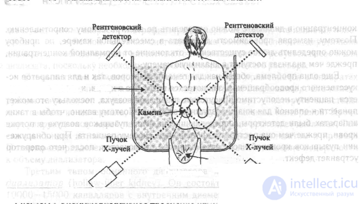 8. Possibilities of using physical fields for the destruction of biological tissue. Laser, electronic and ultrasonic scalpels