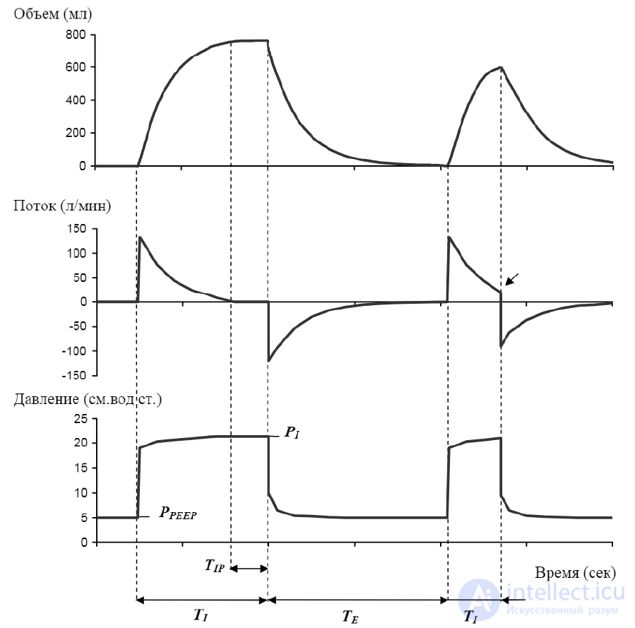 21- Anaesthesia-respiratory apparatus, Classification and principle of operation of ALV, Artificial lung ventilation apparatus