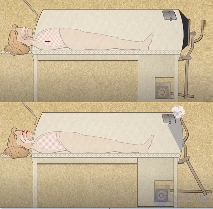 21- Anaesthesia-respiratory apparatus, Classification and principle of operation of ALV, Artificial lung ventilation apparatus