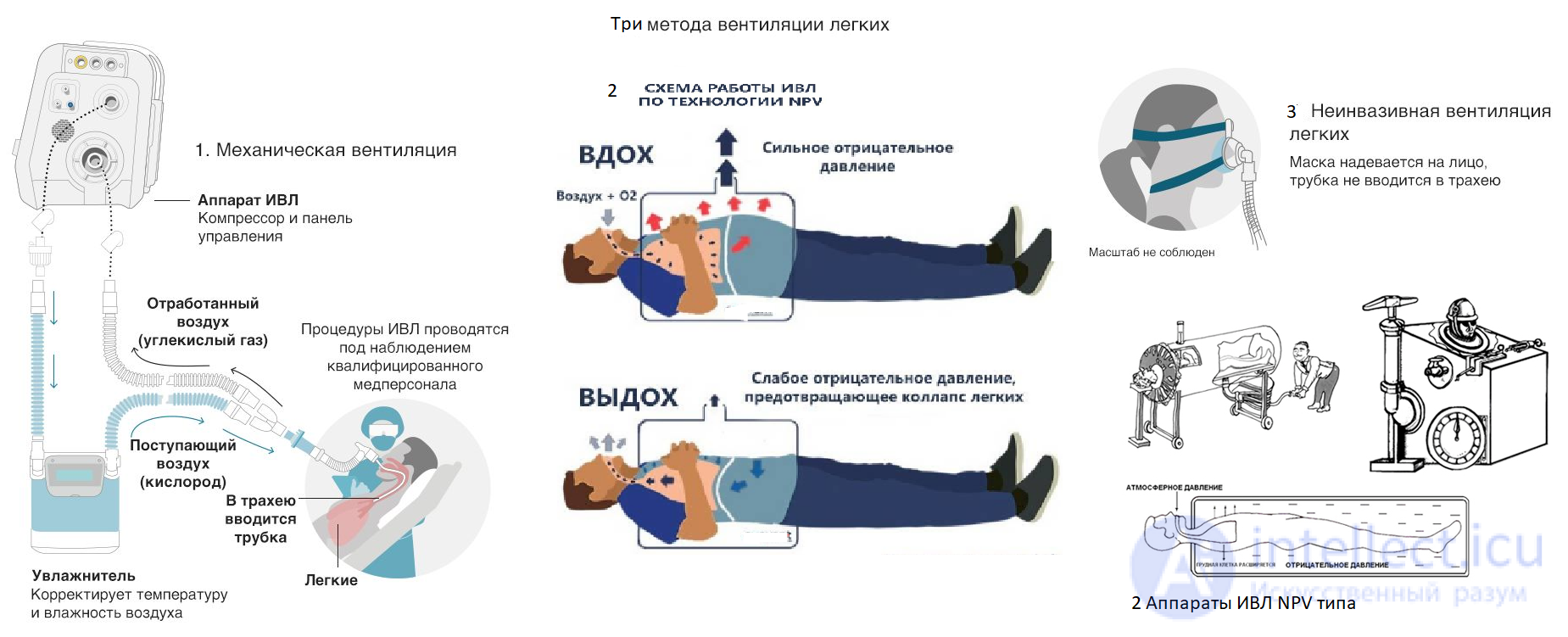 21- Anaesthesia-respiratory apparatus, Classification and principle of operation of ALV, Artificial lung ventilation apparatus
