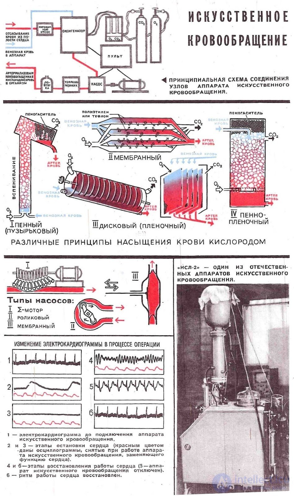 Equipment for circulatory support, artificial heart