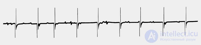 2.3. Indicators of Cardiovascular System Activity, Muscular System Activity, Eye Reactions