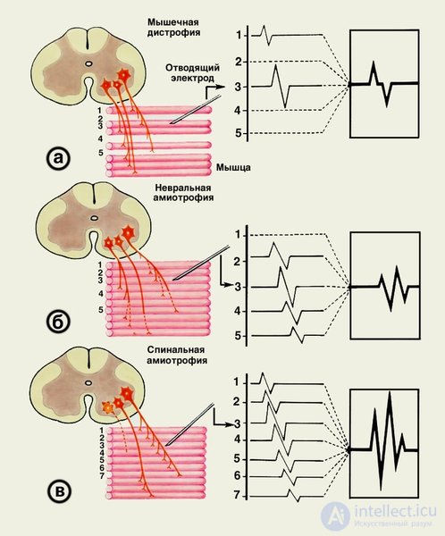 2.3. Indicators of Cardiovascular System Activity, Muscular System Activity, Eye Reactions