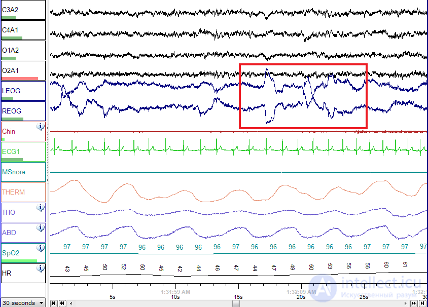 2.3. Indicators of Cardiovascular System Activity, Muscular System Activity, Eye Reactions