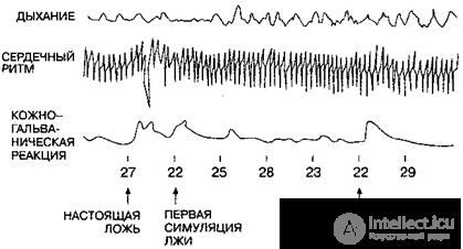 2.7. The Lie Detector - the Polygraph, Recording a Complex of Physiological Indicators (EDA, EEG, Plethysmogram, etc.)