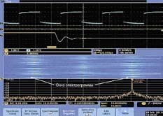 Oscilloscope, Logic Analyzer, Spectrum Analyzer - Diagnostic Tools