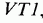Integrated Amplifiers: Integrated Operational Amplifiers