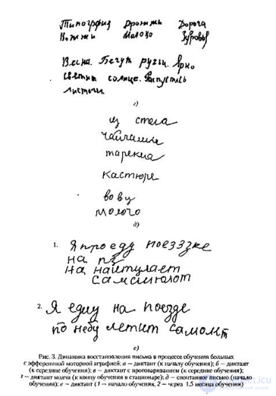 5.2. Efferent (Kinetic) Motor Agraphia