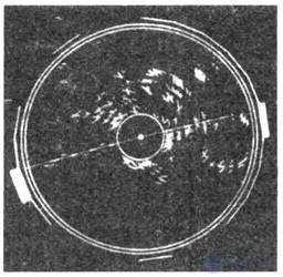 COORDINATE DETECTORS (position-sensitive detectors)