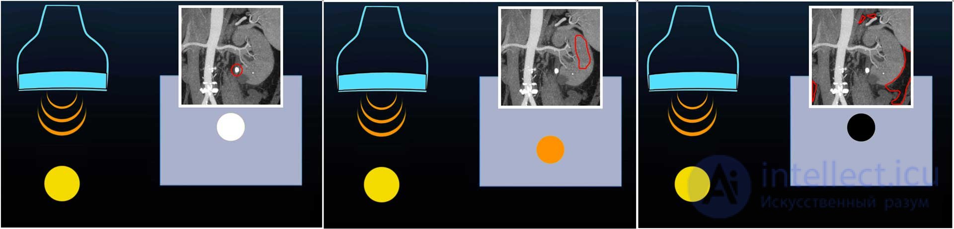Design and Principle of Operation of Ultrasound Transducers: Classification and Features