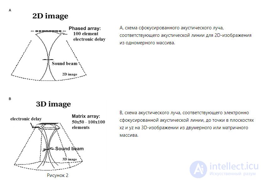 Design and Principle of Operation of Ultrasound Transducers: Classification and Features